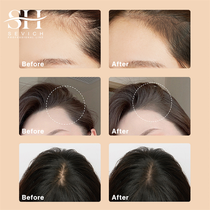 SEVICH 12g Hairline Powder Wit - đánh giá và giá Rooting Hormone Powder